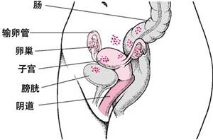 痛经的你要谨慎这六种疾病,痛经淤堵看过来