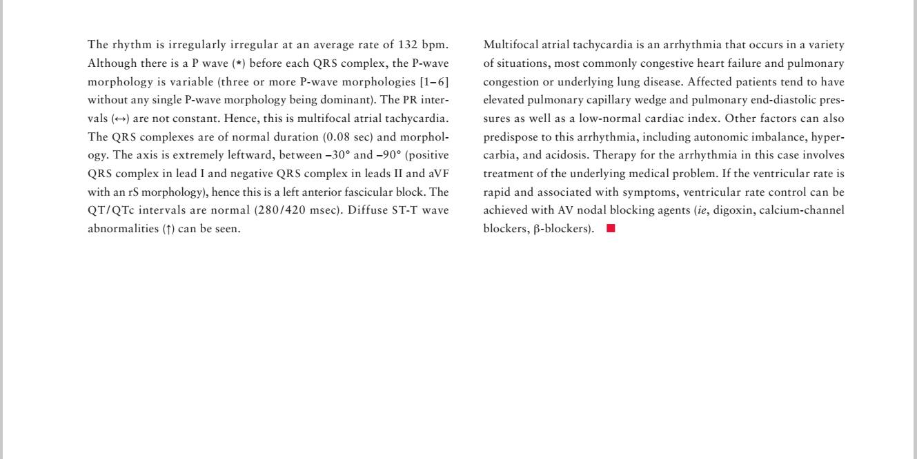 「读心有术」164期：这种多源性房速需要治疗吗？