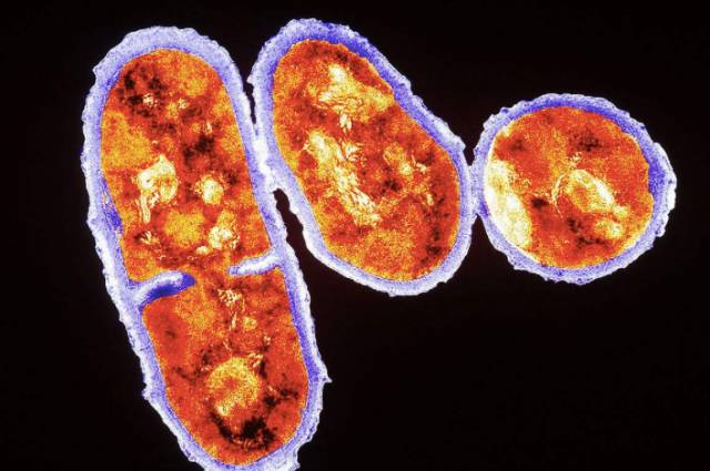 多年的痘痘被彻彻底底解决,困扰多年的痘痘终于好了