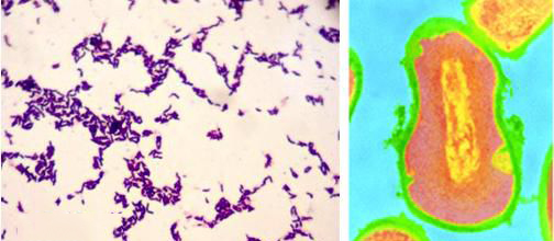 多年的痘痘被彻彻底底解决,困扰多年的痘痘终于好了