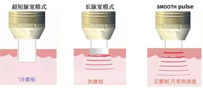 徐医附院美容中心整形案例,徐医附院整形美容中心祛痣