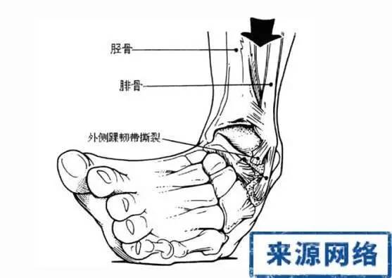 脚踝冷怎么保护,护脚踝防止脚踝过凉