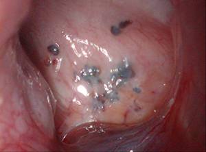 痛经的你要谨慎这六种疾病,痛经淤堵看过来