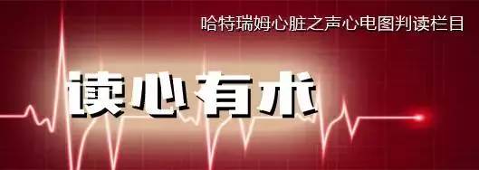 「读心有术」164期：这种多源性房速需要治疗吗？