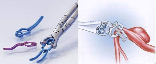 牙齿有金属填充物能不能做磁共振,做磁共振身上带金属会伤害身体吗