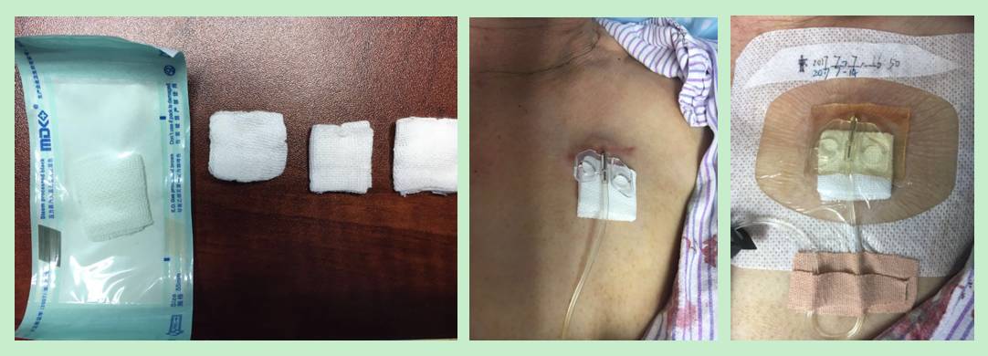 杈撴恫娓澏缈奸拡绫诲瀷,杈撴恫娓澏缈奸拡鍥剧墖