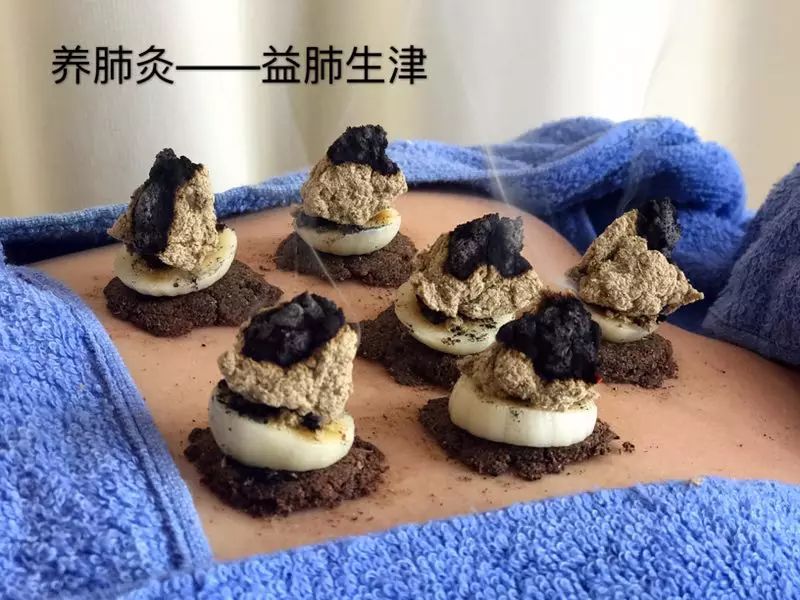 一叶知秋，雪中送炭话艾灸