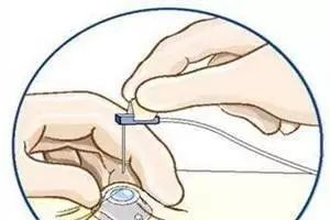 杈撴恫娓澏缈奸拡绫诲瀷,杈撴恫娓澏缈奸拡鍥剧墖