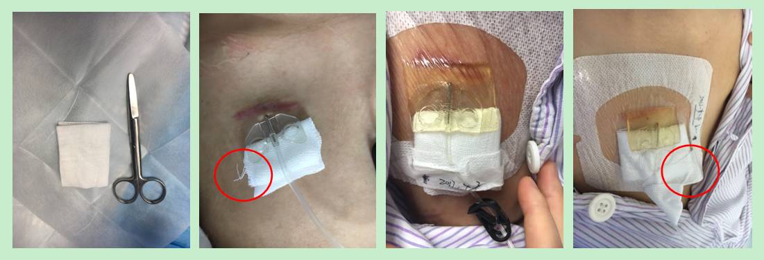 杈撴恫娓澏缈奸拡绫诲瀷,杈撴恫娓澏缈奸拡鍥剧墖