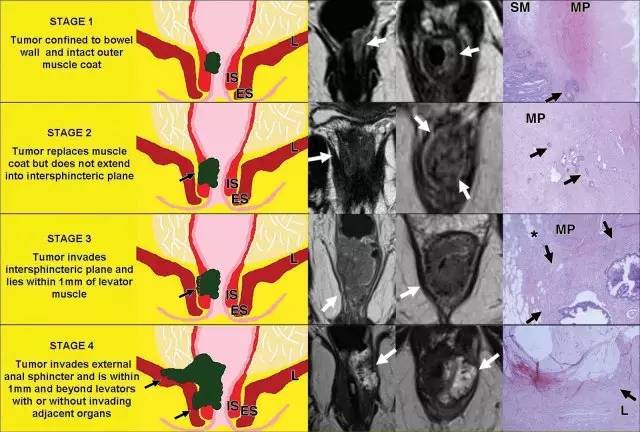 记住一个单词的一般方法,记住癌症九字诀