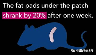 减肥贴的正确方式,减肥要贴什么穴位