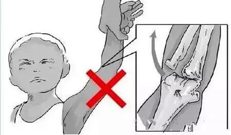 宝宝胳膊掉环反复的概率多大,三岁孩子掉胳膊