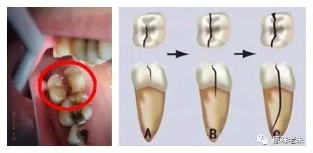 920爱牙日·牙齿酸软请心疼自己，80%的解决办法都在这里了，请自取