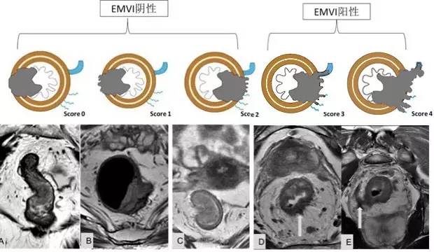 记住一个单词的一般方法,记住癌症九字诀