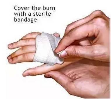 小舒答疑丨烧伤后如何紧急处理？抹牙膏靠谱吗？