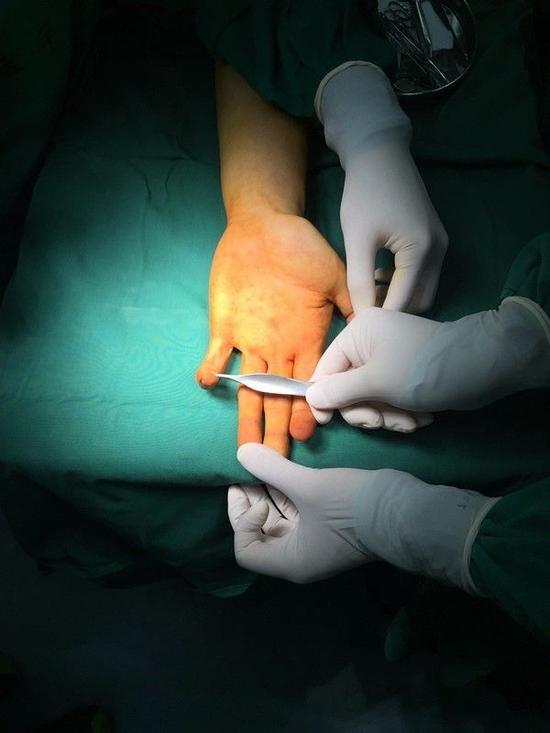 孙悦命中率最低,孙悦在哪做的手术