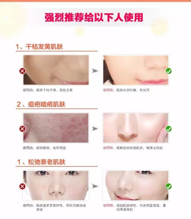 城野医生收缩水如何验证正品,城野医生可替代的水