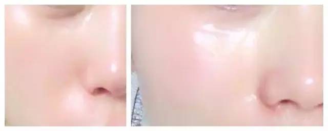 城野医生收缩水如何验证正品,城野医生可替代的水