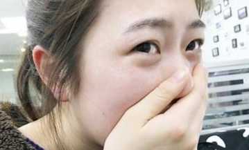 出汗有气味什么原因汗有这种味道或是尿毒症