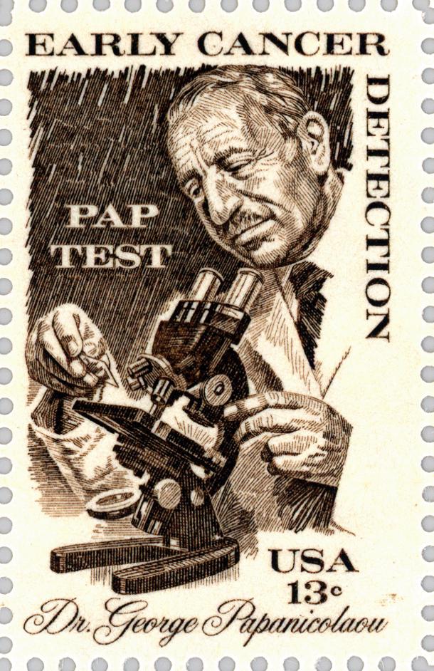 宫颈刮片图片报告单,怎么看宫颈刮片