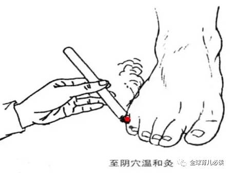 胎位不正婆婆让顺产,顺产胎位不正压肚子