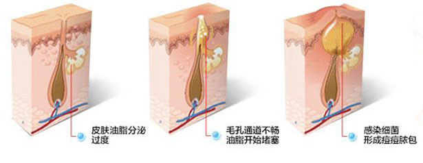 qa互动,qaq第一期完整视频