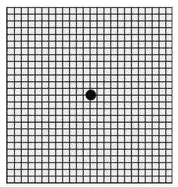 黄斑病变的克星,得了黄斑病变需要忌什么食物