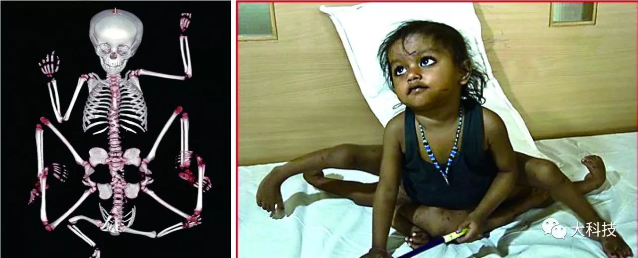 身体里长出器官,身体多出一个器官