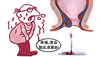 便秘出血要及时就医
