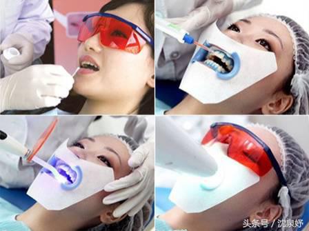 每天刷牙牙齿还黄？学会这些是美白牙齿的关键