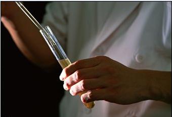 怎么看懂尿常规化验单,一文教你看懂肝功能报告单