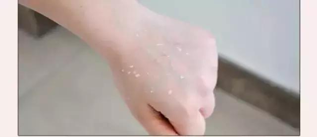 最好用的气垫bb霜是什么品牌,夏天用的气垫bb霜