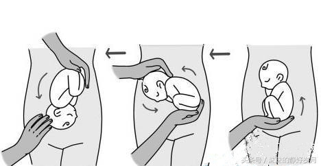 孕26周宝宝臀位还能转过来吗,孕晚期胎宝宝还是喜欢臀位