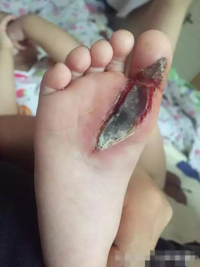 家有宝宝的时刻关注孩子的牙齿,家有宝宝的家长请关注