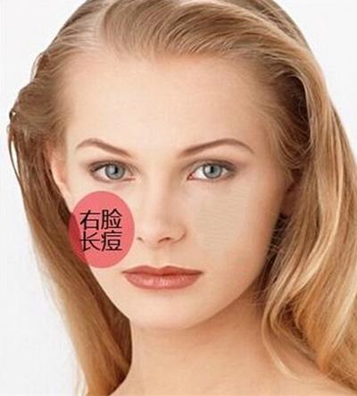 针对长在不同部位的痘痘，教你祛痘秘诀，还你18岁美丽肌肤！