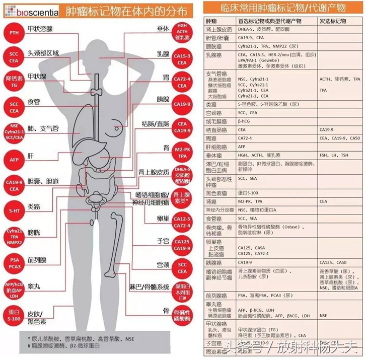 体检中afp是什么项目,体检afp偏高要挂什么科