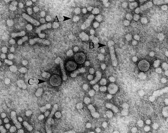 病毒性肝炎到肝癌需要多久,消除病毒性肝炎进入倒计时