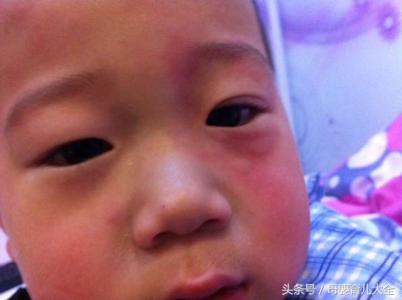 回了趟老家身上起疙瘩,宝宝回老家身上就出疙瘩怎么办