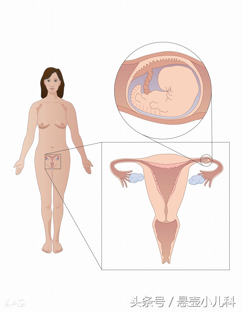 输卵管粘连宫外孕发病率,人工授精宫外孕发病率