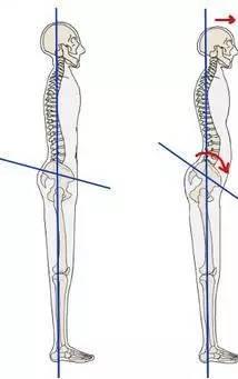 徒手整形许强分享：原来骨盆不正对女性影响这么大