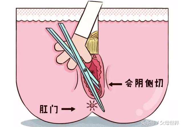 准妈妈需牢记分娩的问题,孕妇如何避免侧切和撕裂