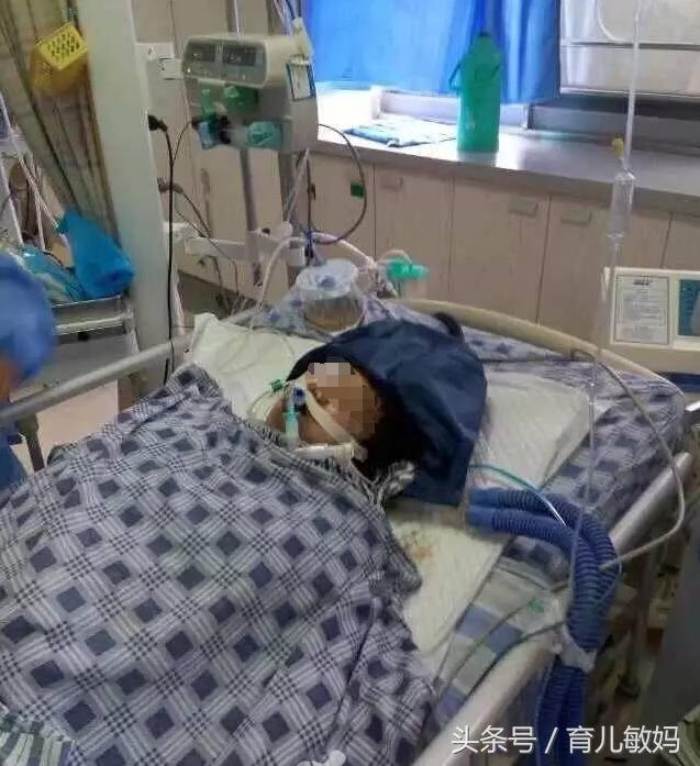 剖腹产41天向前摔了一下有事吗,剖腹产后第二天起床就头晕头疼