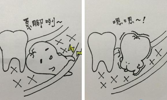 拔智齿拆线后吐口水有血色,拔智齿后吐不了棉球怎么办