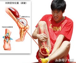 跟腱炎如何才能算是真正的好了,如果有跟腱炎应该怎么样练