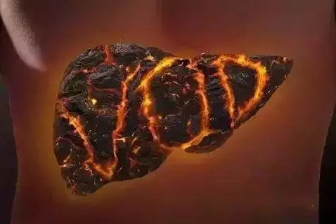 肝火旺盛口干舌燥怎么调理,女性口干舌燥是什么原因怎么解决