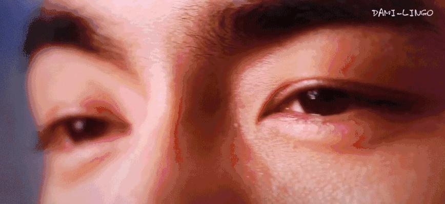 用了眼霜之后长脂肪粒怎么消除,眼霜用了长脂肪粒怎么消除