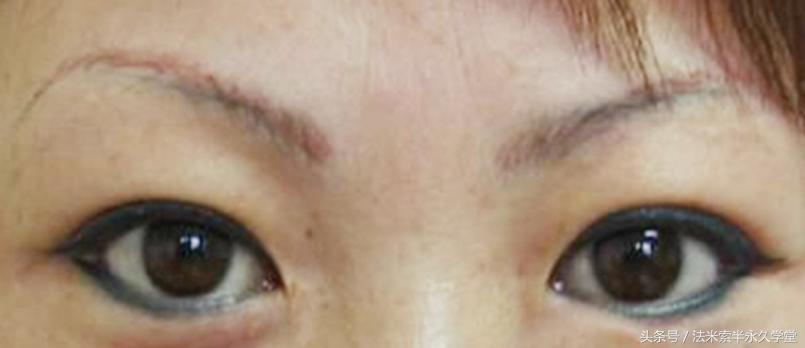 刚做好的美瞳线发蓝还能补救吗,如何防止美瞳掉出来