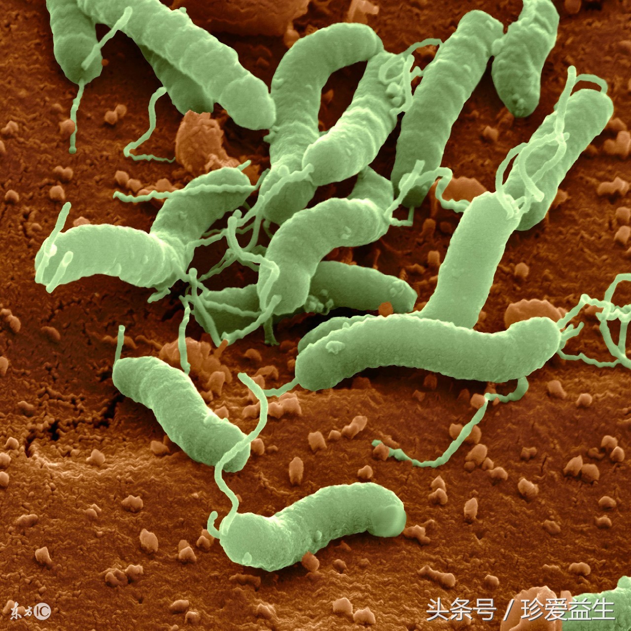 你知道，你已深陷肿瘤的包围圈吗？