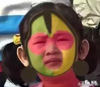 做了个达拉斯隆鼻，假体直接戳到脑门，我是不是和张檬、刘雨欣遇到了同一个医生！