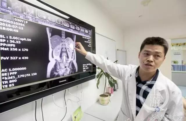 刚发现怀孕胎儿什么样,明明怀孕却查不出胎儿